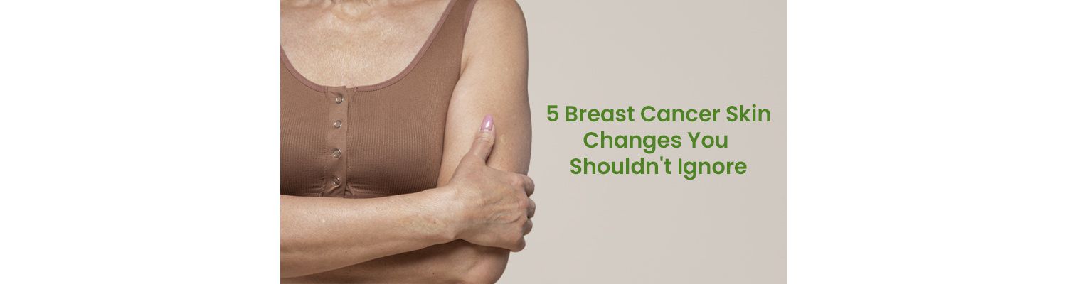 5 Breast Cancer Skin Changes You Shouldn't Ignore