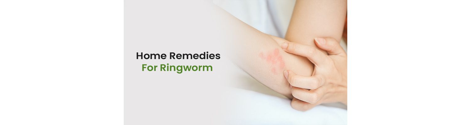 Home Remedies For Ringworm