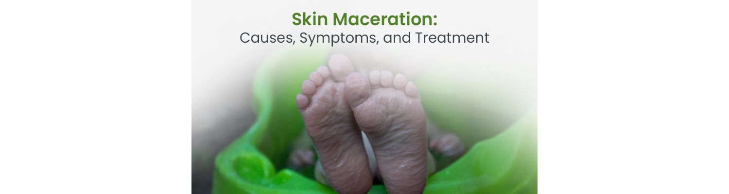 Skin Maceration: Causes, Symptoms, and Treatment