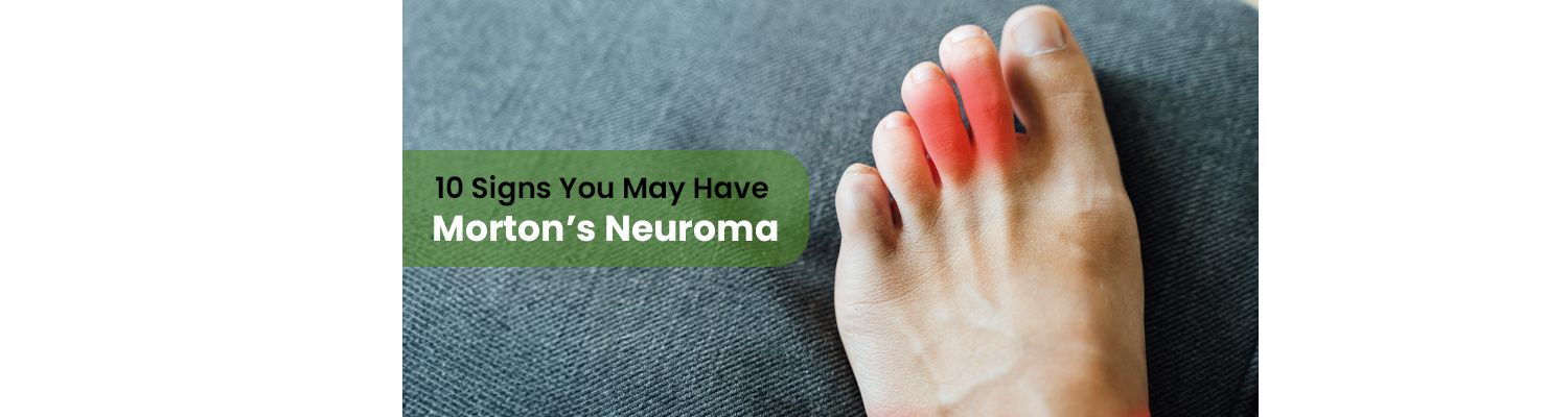 10 Signs You May Have Morton’s Neuroma