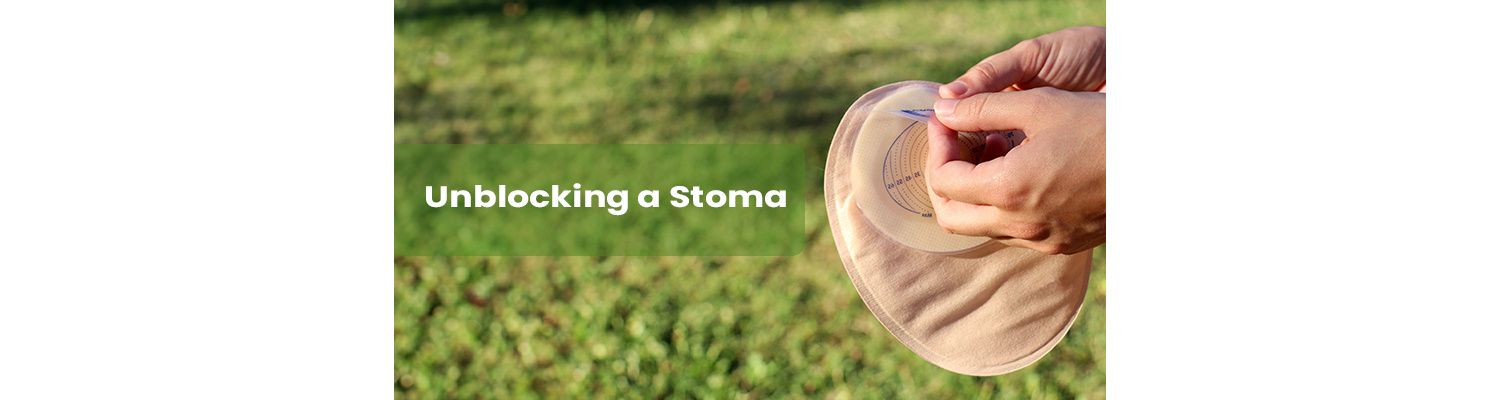 How To Unblock A Stoma