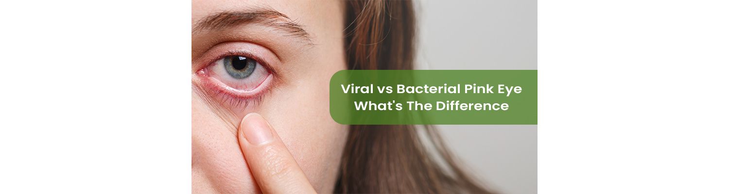 Viral vs Bacterial Pink Eye: What's The Difference?