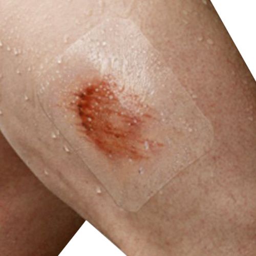 Nexcare Tegaderm Transparent Dressing - Waterproof