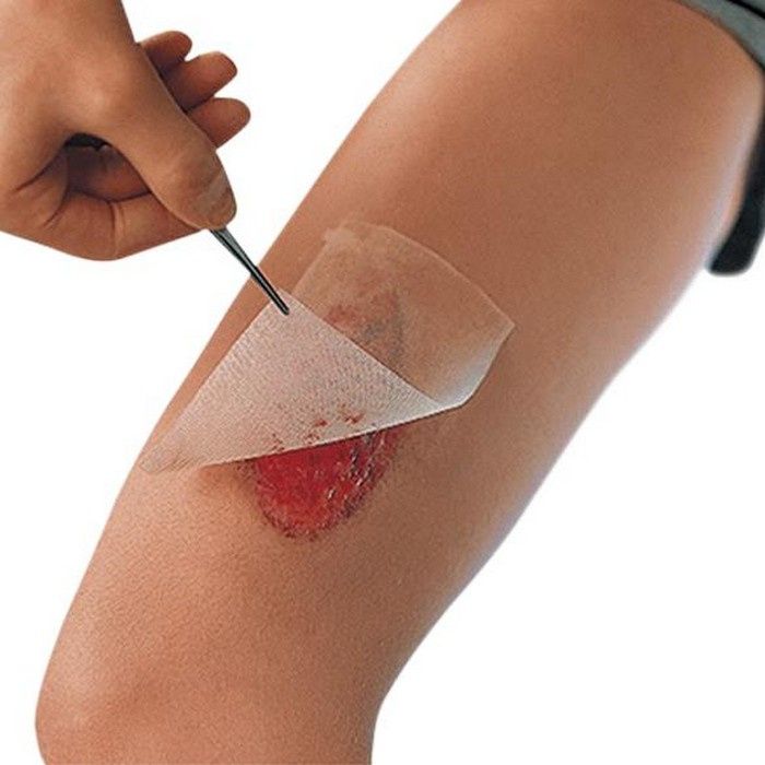 dressing for cuts Wound Cleaning and Dressing