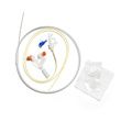 CORFLO Percutaneous Endoscopic Jejunal Feeding Tube