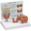 Anatomical Thyroid Disease Model