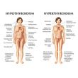 Anatomical Thyroid Disease Model