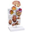 Anatomical Hypertension Model Set