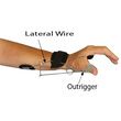 Oppenheimer Coiled Spring Wire Orthosis with Description