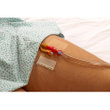 Dale Hold-n-Place Foley Catheter Holder
