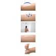 Transparent Film Dressing
