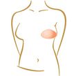 BAlance Contact Varia Breast Form