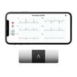 AliveCor KardiaMobile Electrocardiograph