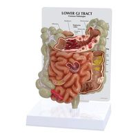 Buy Anatomical Lower GI Tract Model