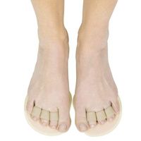 Buy Vive Triple Toe Splint