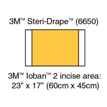 Buy 3M Ioban 2 Antimicrobial Incise Drape