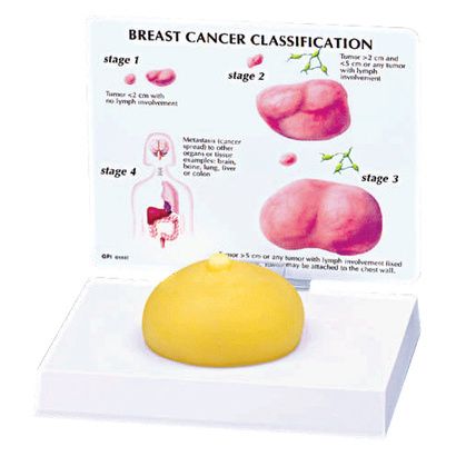 Buy Anatomical Breast Cancer Model