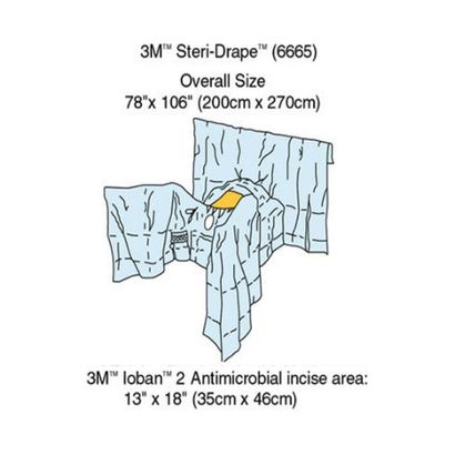 Buy 3M General Steri-Drape Abdominal Perineal with Incise Film