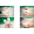 Sorbion Sachet S Drainage Dressing Application