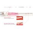 Pink - IV Catheter
